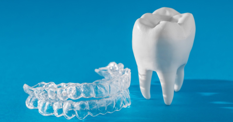 Can I Use Teeth Whitening Products During Invisalign Treatment?