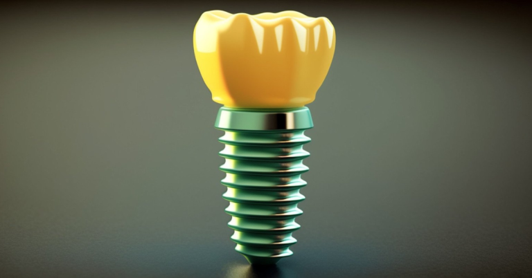 What Is The Recovery Process Like After Dental Implant Surgery?