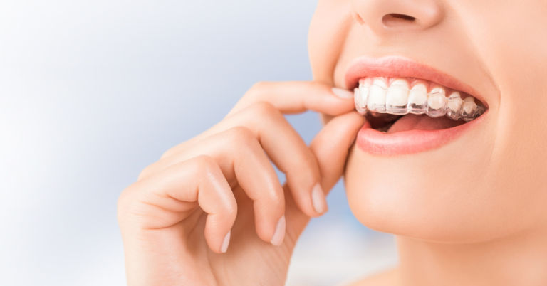 Can I use Invisalign if I have a dental bridge or missing teeth?