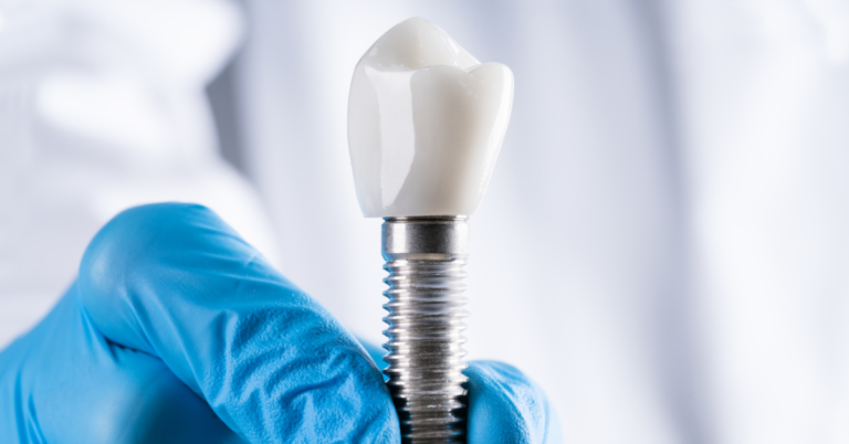 How long after tooth extraction can I get a dental implant?