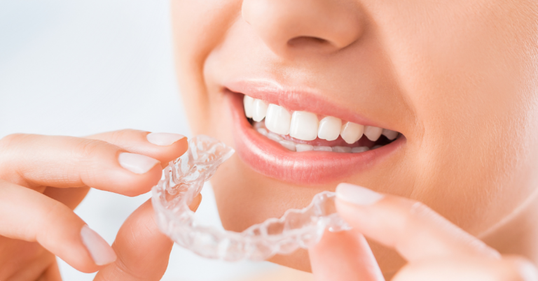 What is the average success rate of Invisalign treatment?